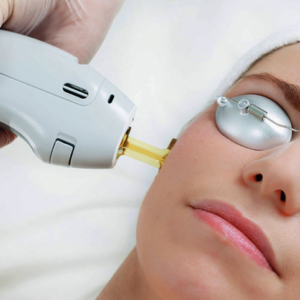 Sesión láser ND-Yag